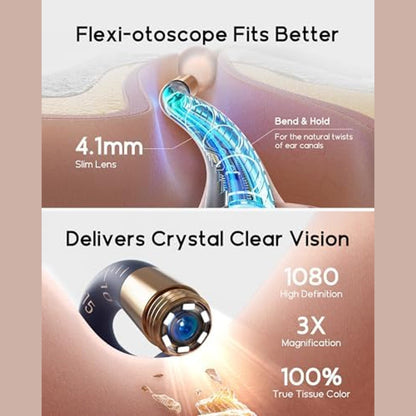 Bebird EarSight Plus | أداة إزالة شمع الأذن مع كاميرا - I35R
